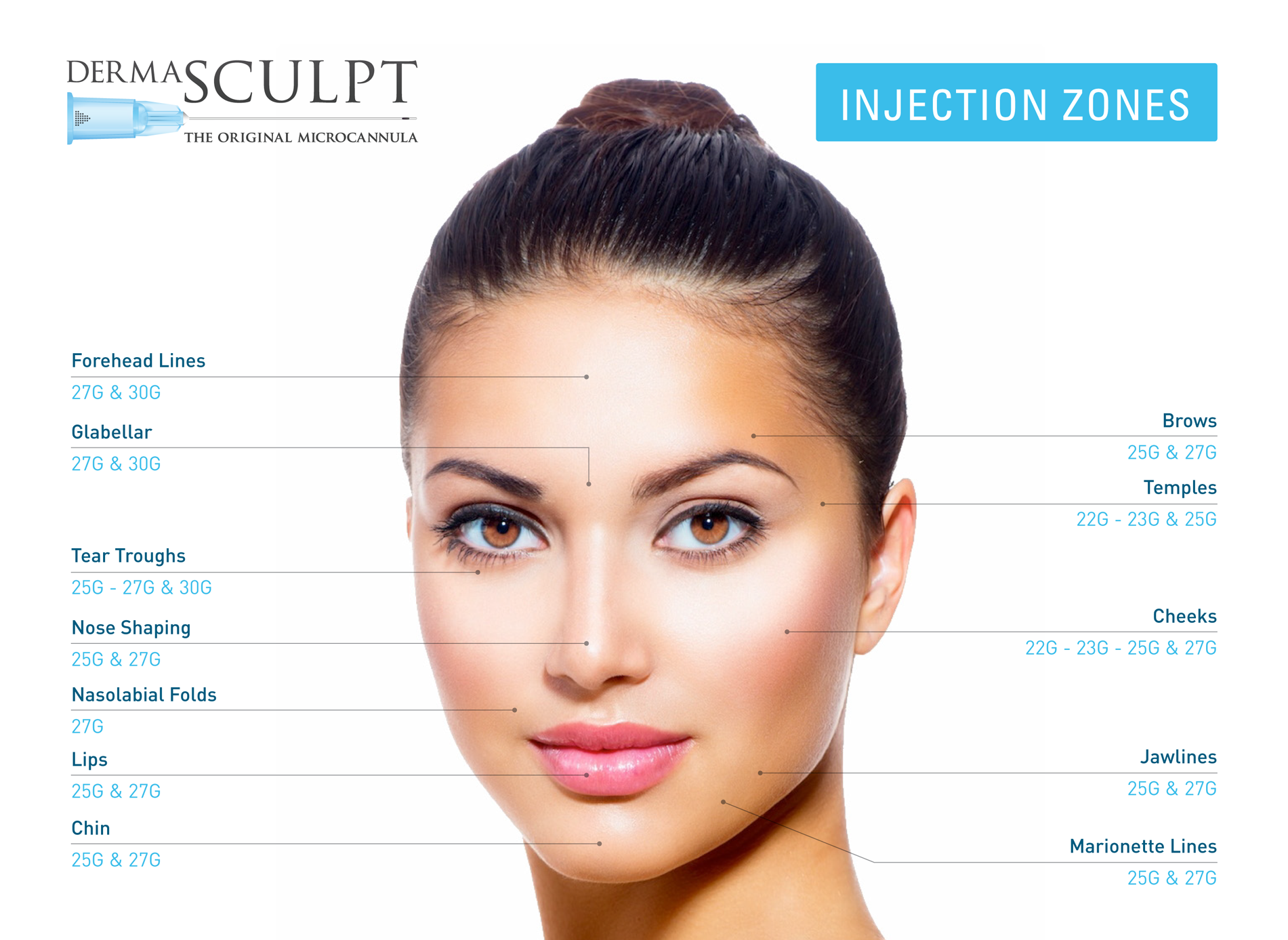 dermasculpt-injection-zones