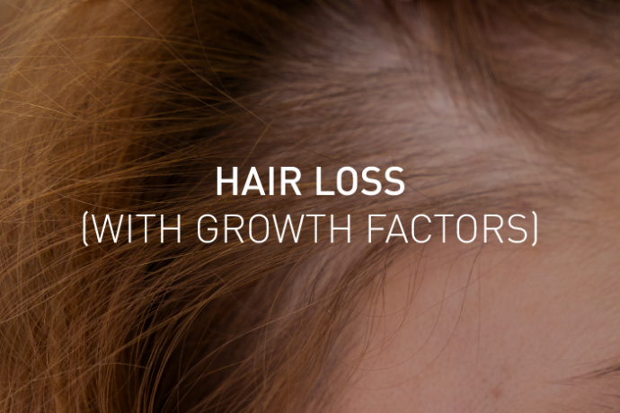 hair-loss